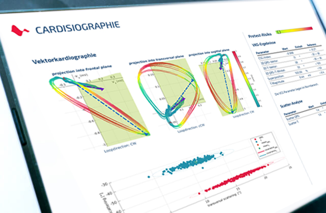 Cardisiographie Screenshot 1