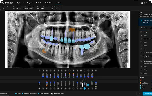 Align X-ray Insights Screenshot 1