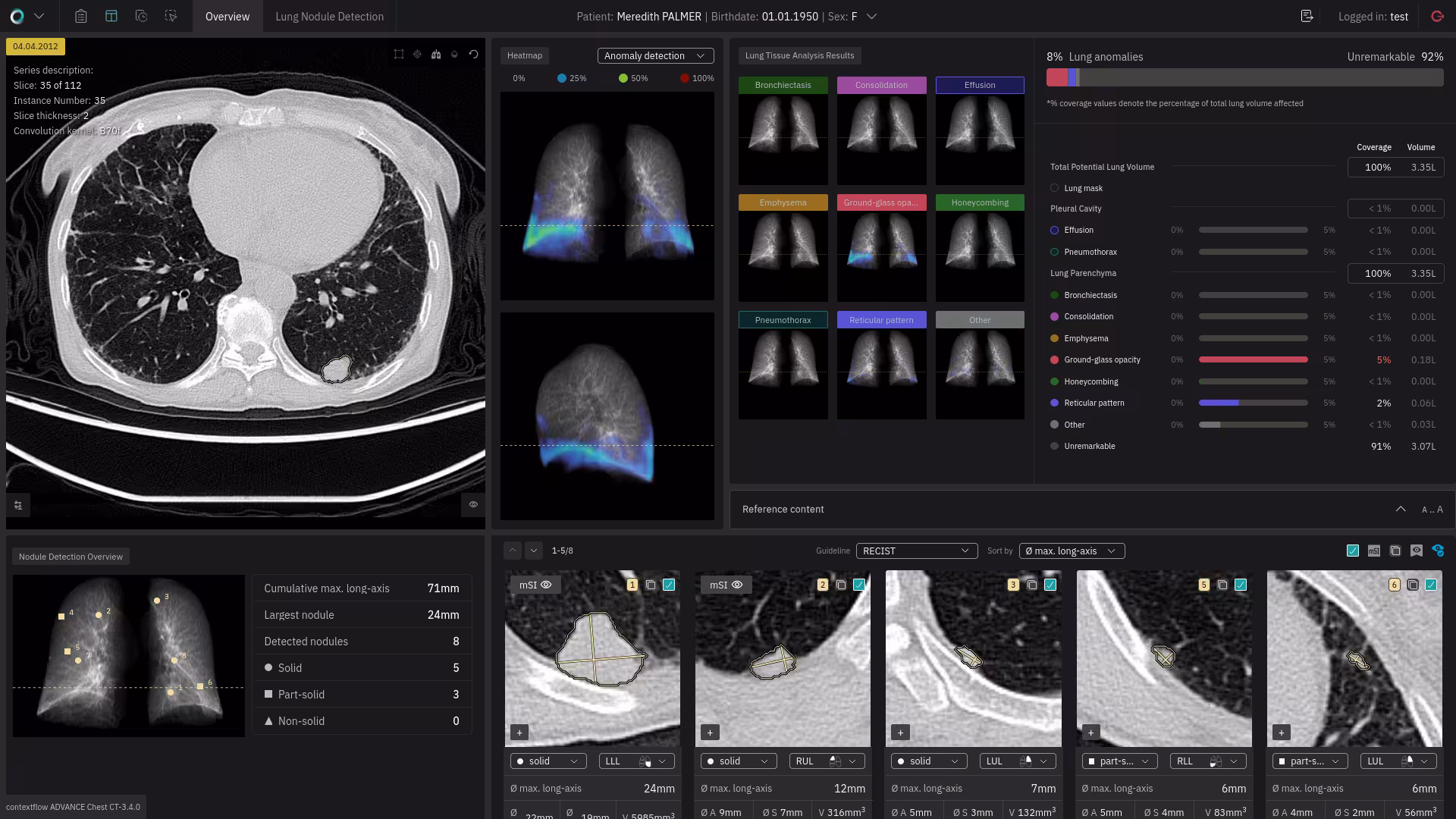 ADVANCE Chest CT Screenshot 1